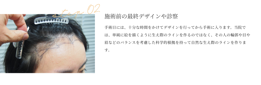 施術前の最終デザインや診察