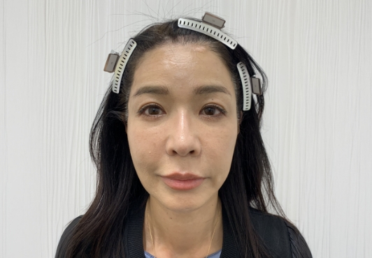 綿密なカウンセリング・診察。セカンドオピニオンも対応可。