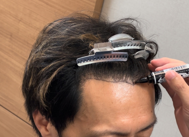 施術前最終デザイン